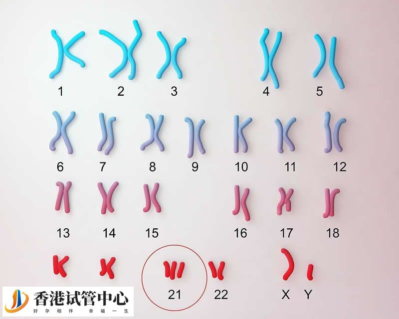 男性Y染色體微缺失造成的不孕