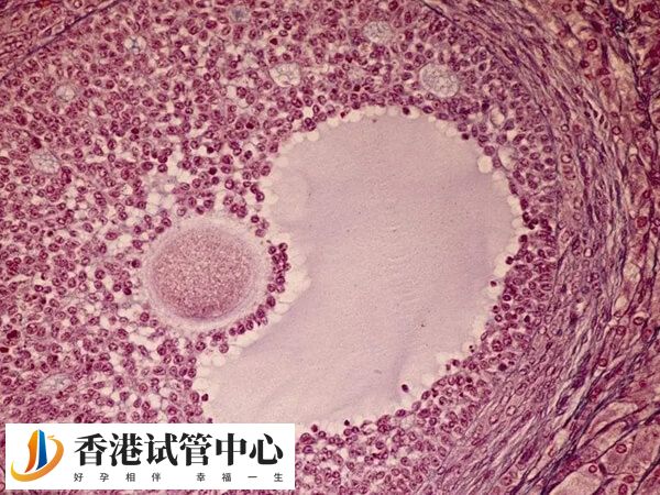 黃素化有類排卵表現但卻幾乎不可能懷孕