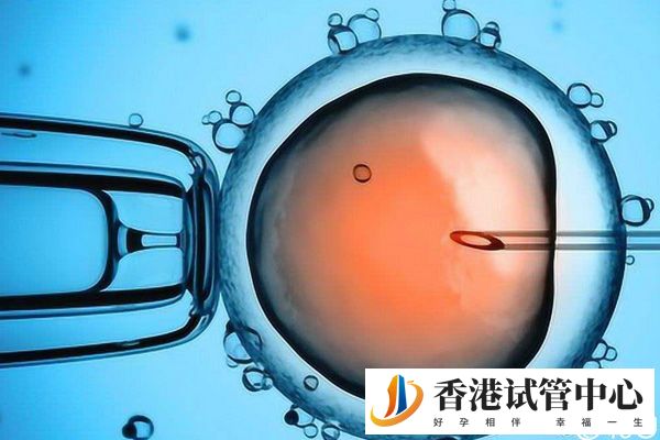 香港凍卵全流程分享，需不需要老公簽字別還不知道