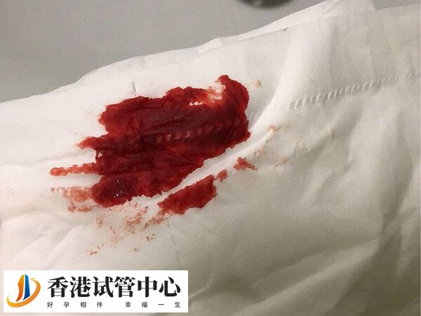 移植鮮胚第五天出血是不是失敗了
