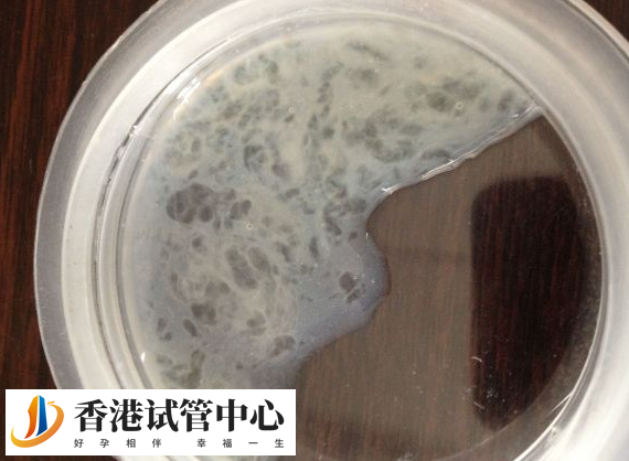 申請供精試管失敗后會不會保留精源