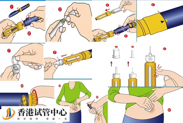 試管嬰兒促排打完普麗康能洗澡，注意沐浴水溫、時(shí)間很重要
