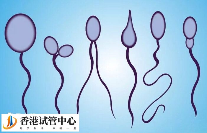 精子形態異常率過高可能導致受精失敗