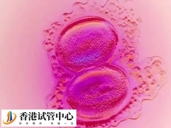 子宮內(nèi)膜異位會影響胚胎著床