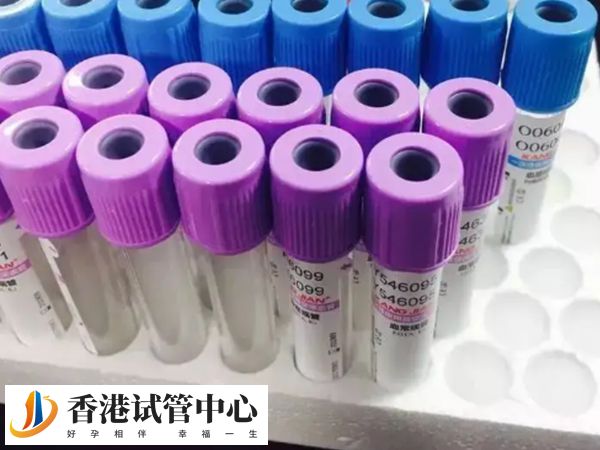 查FSH水平次數(shù)因人而異
