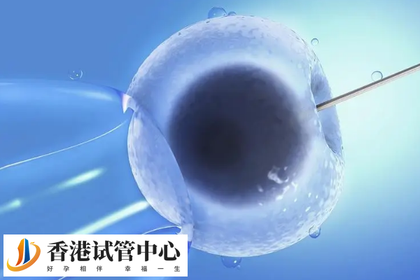 穿靜脈曲張襪的時(shí)間通常為2到4周