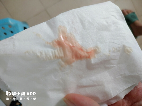 子宮出血是排卵障礙的癥狀之一