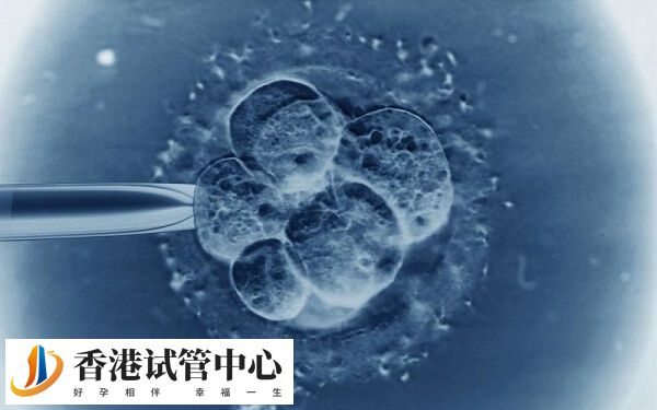 養(yǎng)囊是一個(gè)優(yōu)勝劣汰的過(guò)程