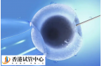 取卵后靜脈曲張襪要穿幾天