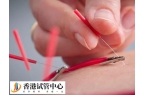 試管促排期間用電針好不好